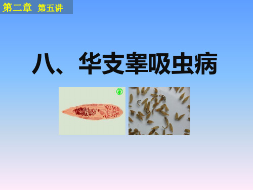 华支睾吸虫病前殖吸虫病和棘口吸虫病