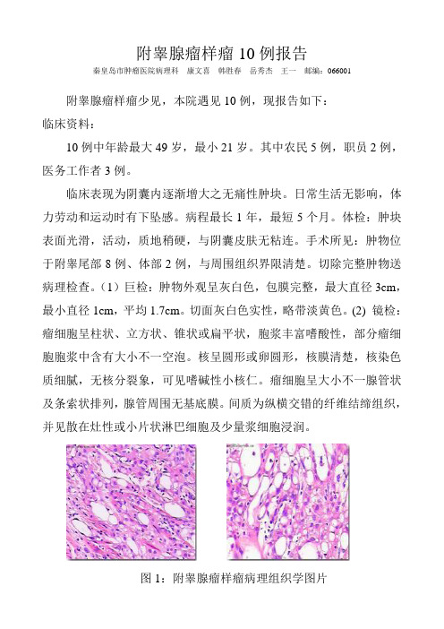 附睾腺瘤样瘤10例报告