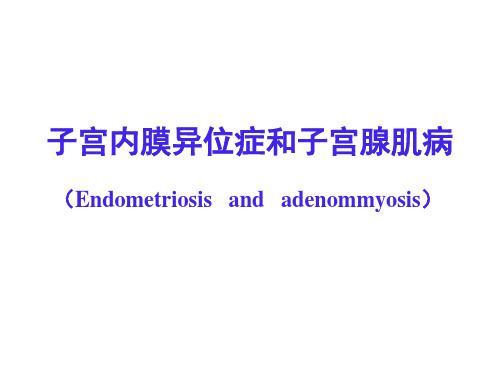 子宫内膜异位症和腺肌病教学ppt