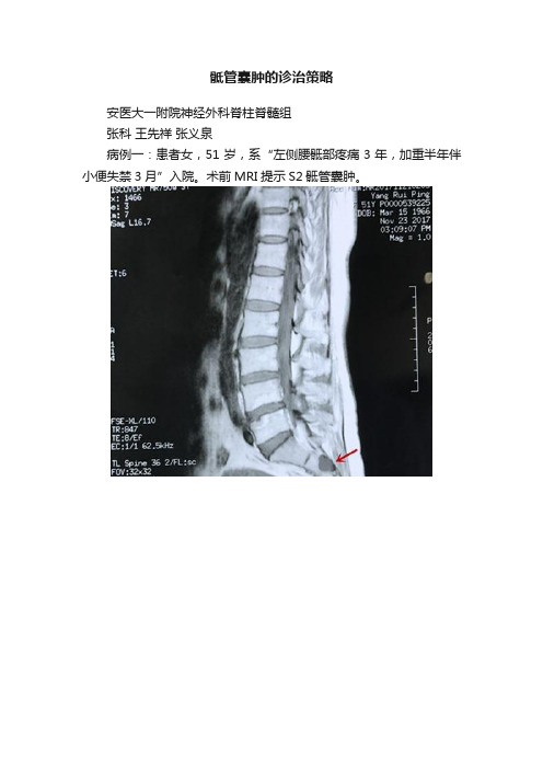 骶管囊肿的诊治策略