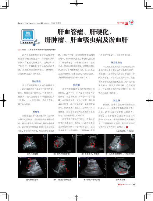 肝血管瘤、肝硬化、肝肿瘤、肝血吸虫病及淤血肝