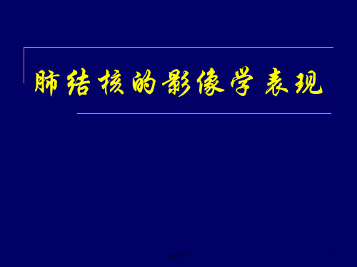 肺结核的影像学表现  ppt课件