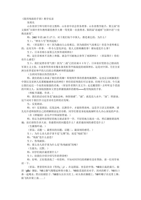 我用残损的手掌