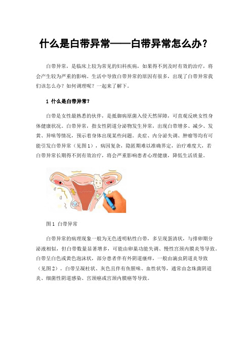 什么是白带异常——白带异常怎么办？