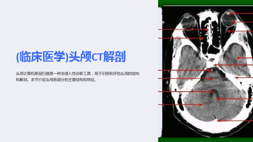 (临床医学)头颅CT解剖