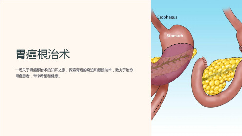 《胃癌根治术》课件