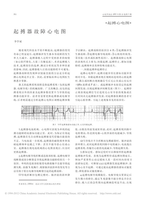 起搏器故障心电图李学斌