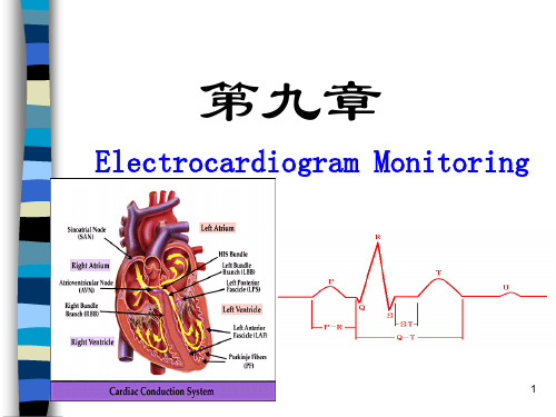 ECG监测PPT课件