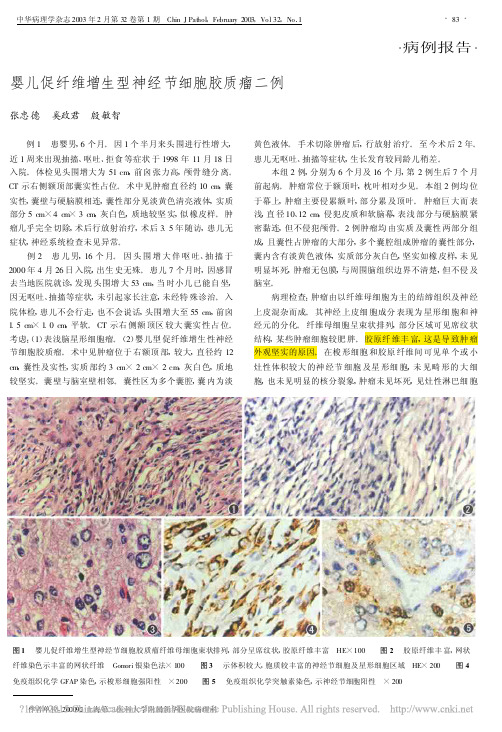 婴儿促纤维增生型神经节细胞胶质瘤二例_张忠德