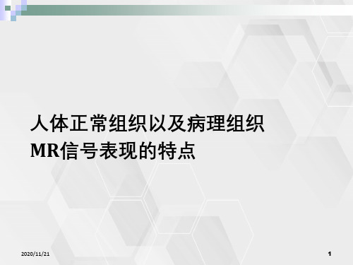 人体正常组织以及病理组织MR信号表现特点