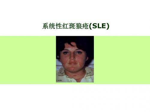 系统性红斑狼疮(SLE)课件