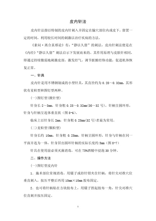 皮内针法-针灸推拿学
