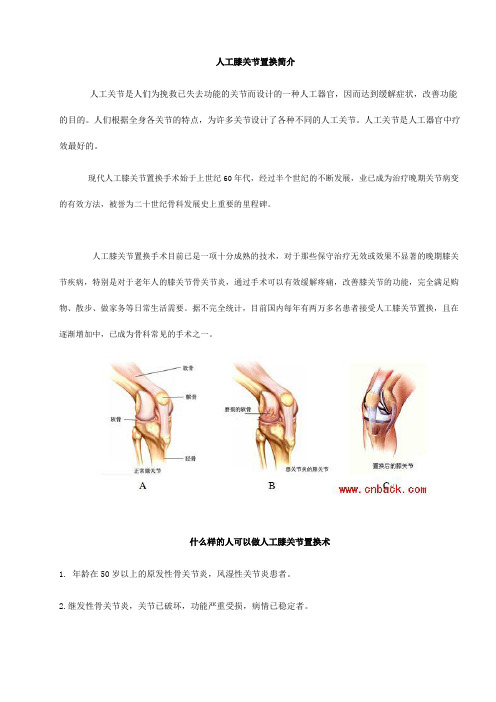 人工膝关节置换手术步骤全解-共19页