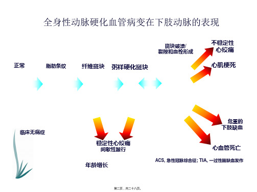 下肢动脉硬化闭塞症诊治指南