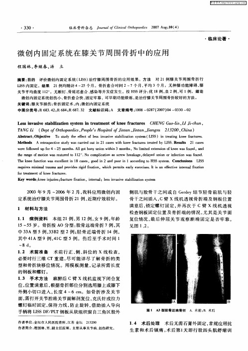 微创内固定系统在膝关节周围骨折中的应用