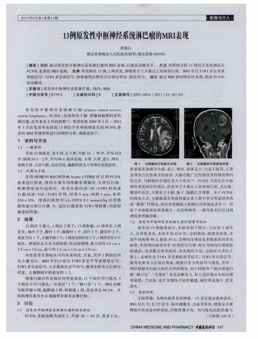 13例原发性中枢神经系统淋巴瘤的MRI表现