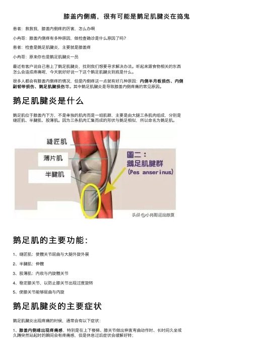 膝盖内侧痛，很有可能是鹅足肌腱炎在捣鬼