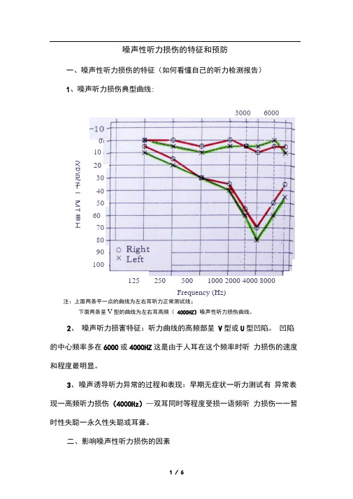 噪声性听力损伤的特征和预防