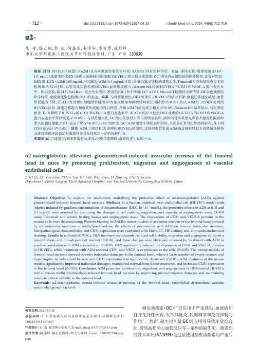 α2-巨球蛋白通过调控血管内皮细胞改善小鼠激素性股骨头坏死