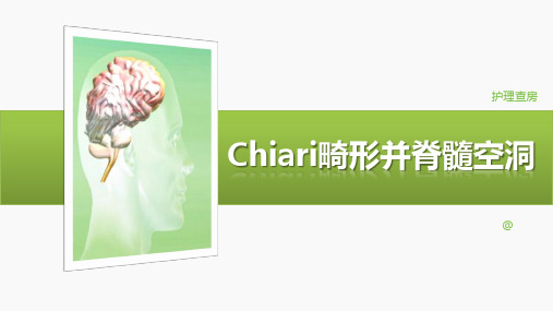 护理查房——Chiari 畸形并脊髓空洞