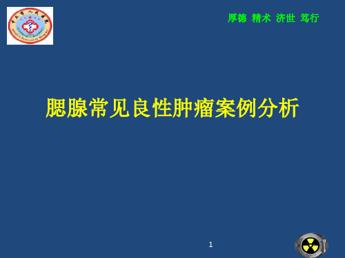 腮腺常见良性肿瘤案例分析PPT课件