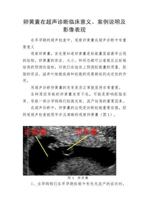 卵黄囊超声诊断临床意义、案例说明及影像表现