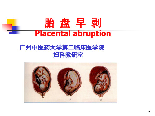 中西医结合胎盘早剥