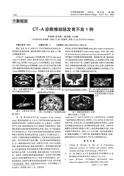 CT-A诊断椎动脉发育不良1例