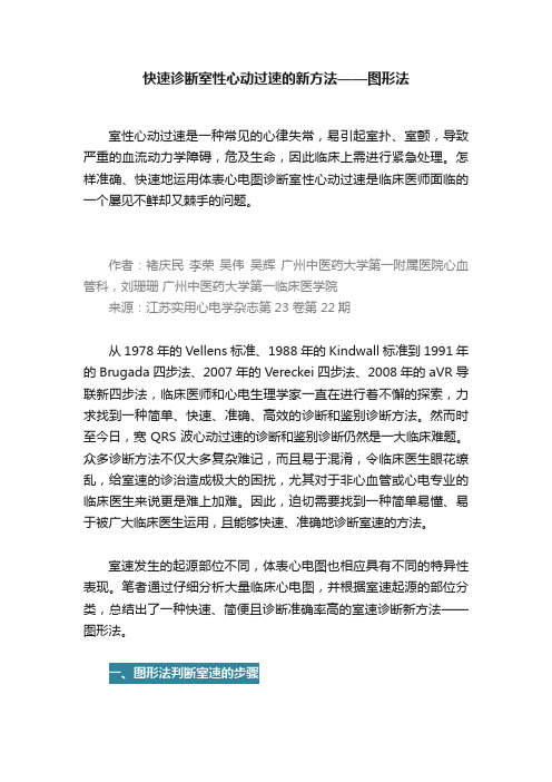 快速诊断室性心动过速的新方法——图形法