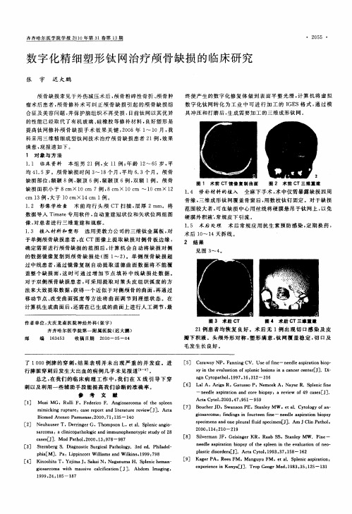 数字化精细塑形钛网治疗颅骨缺损的临床研究