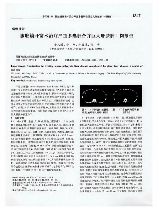 腹腔镜开窗术治疗严重多囊肝合并巨大肝脓肿1例报告