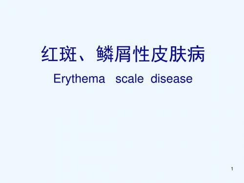 红斑鳞屑性皮肤病PPT课件