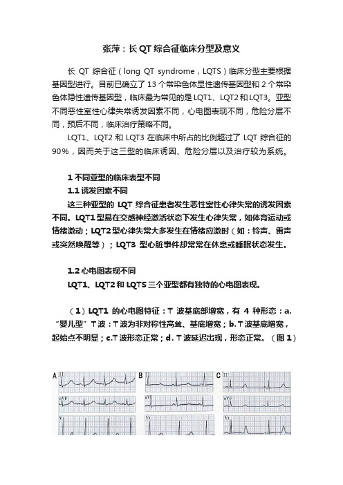 张萍：长QT综合征临床分型及意义