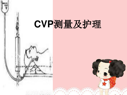 CVP测量