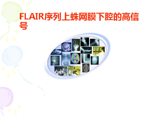 FLAIR_序列上蛛网膜下腔的高信号