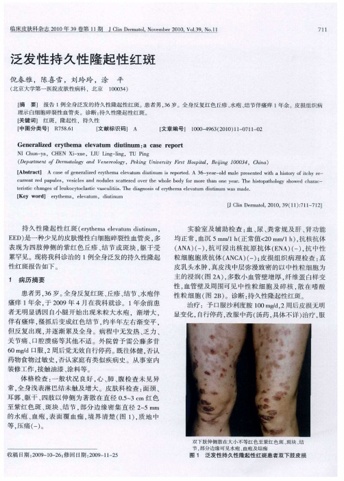 泛发性持久性隆起性红斑