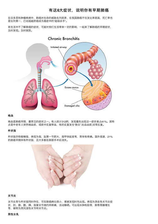 有这6大症状，说明你有早期肺癌