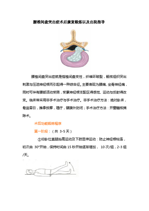 腰椎间盘突出症术后康复锻炼以及出院指导