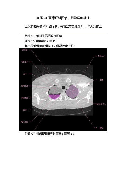 肺部CT高清解剖图谱，附带详细标注