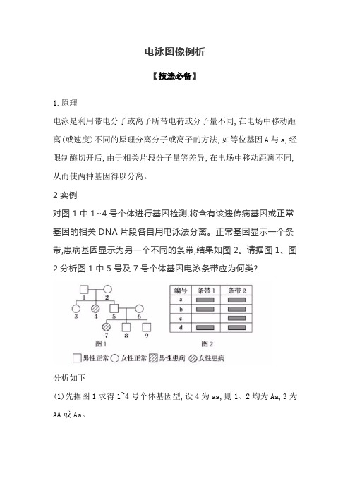 电泳图像例析