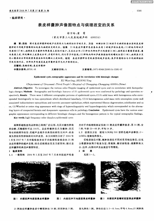 表皮样囊肿声像图特点与病理改变的关系