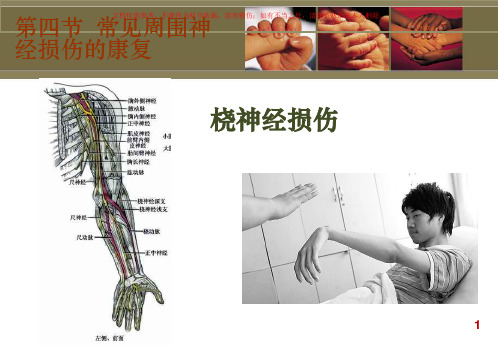 桡神经损伤专业知识课件