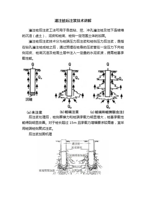 灌注桩后注浆技术讲解