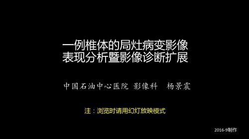 【医看精选PPT】一例椎体的局灶病变影像表现分析暨影像诊断扩展