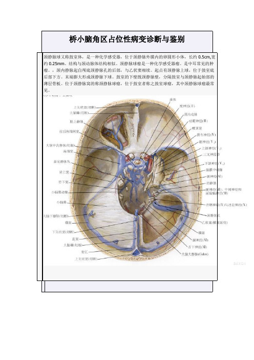 桥小脑角区占位性病变诊断与鉴别