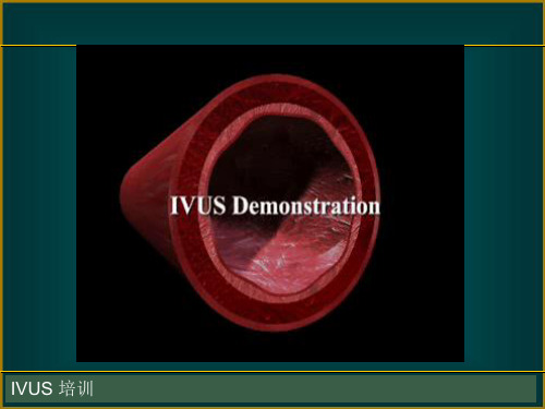 IVUS-血管内超声基础和临床