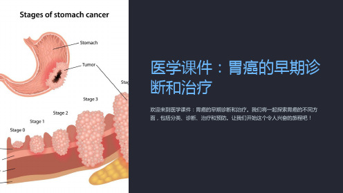 《医学课件：胃癌的早期诊断和治疗》