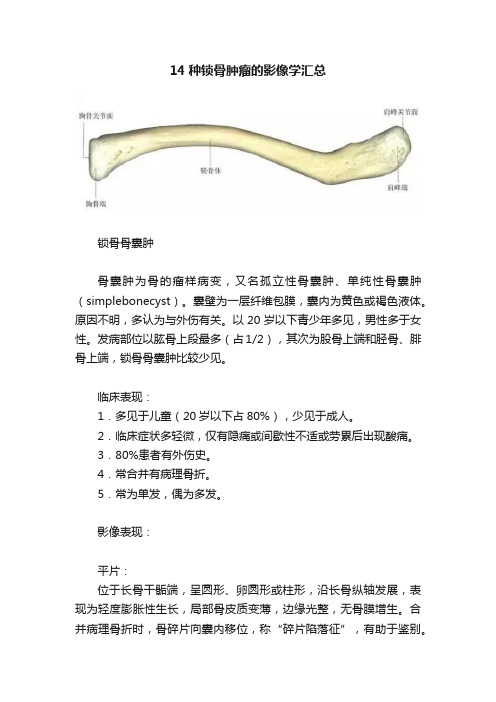 14种锁骨肿瘤的影像学汇总