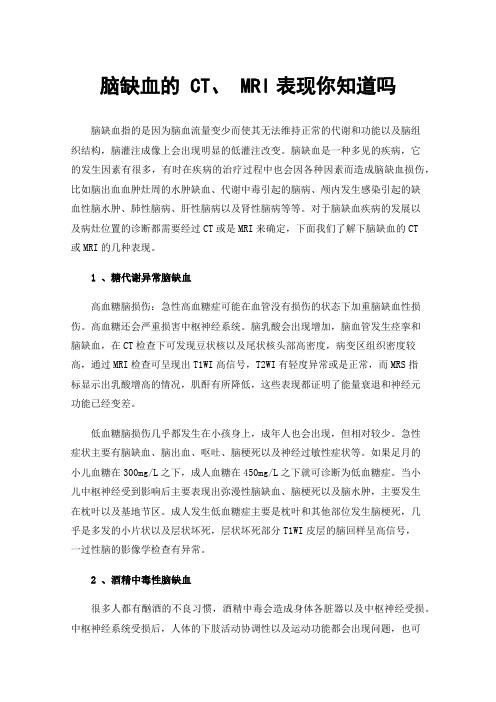 脑缺血的CT、MRI表现你知道吗