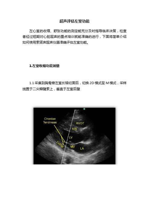 超声评估左室功能